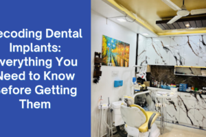 Decoding Dental Implants: Everything You Need to Know Before Getting Them