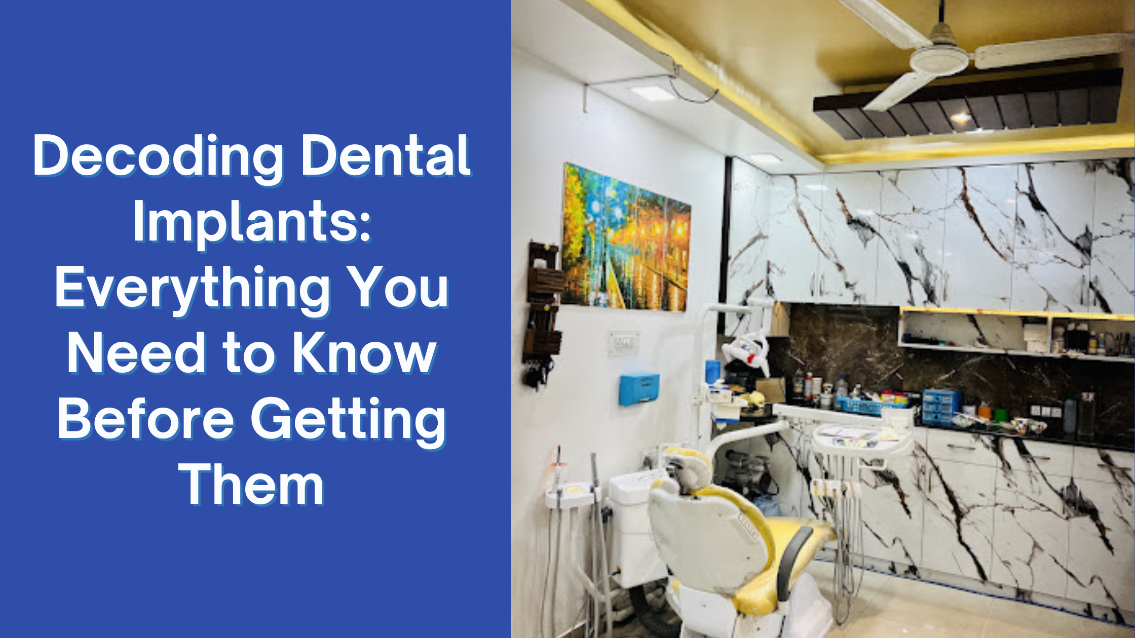 Decoding Dental Implants: Everything You Need to Know Before Getting Them